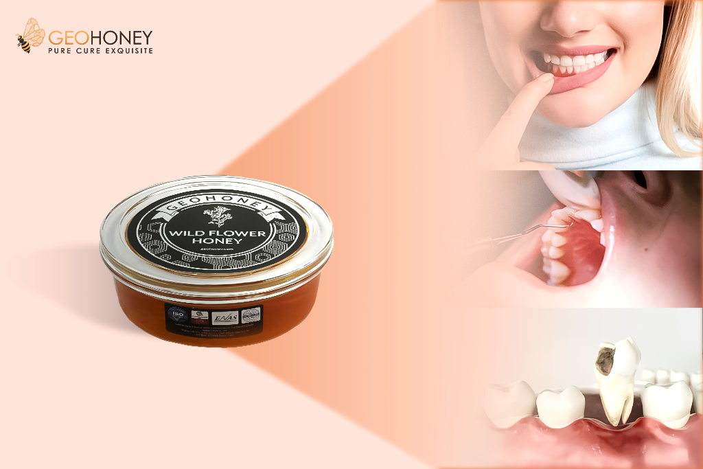 Wildflower Honey – A Natural Cure For Dental Problems